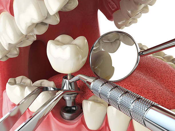 Best Weekend Emergency Dentist in East Alton, IL